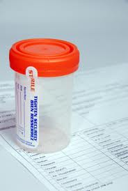 Urine Alcohol Test