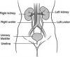 KIDNEY DISEASE TESTS